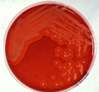 Bakterienkultur