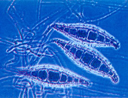 Pilzsporen unter dem Mikroskop